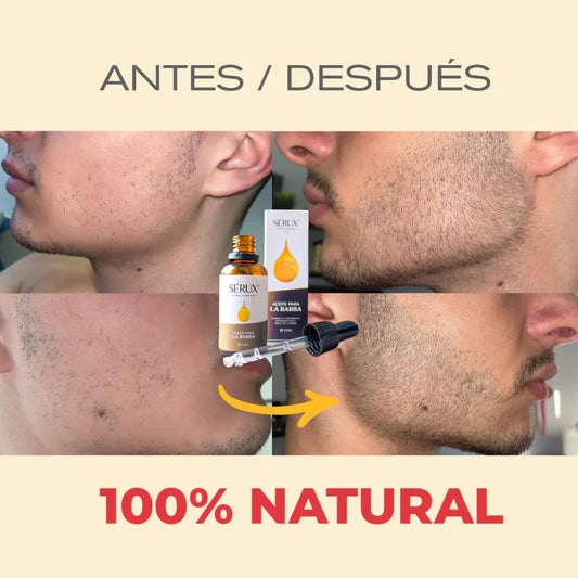 💧 SERUM PARA BARBA: CRECIMIENTO, HIDRATACIÓN Y REDUCCIÓN DE PICOR 🧔🏼